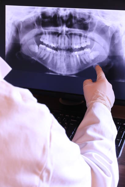 Best Emergency Denture Repair in La Riviera, CA
