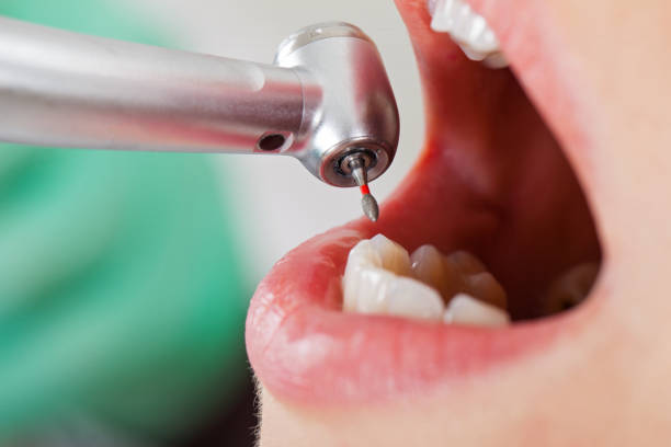 Best Same-Day Emergency Dental Services in La Riviera, CA